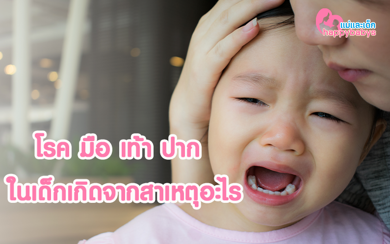 โรคมือเท้าปาก