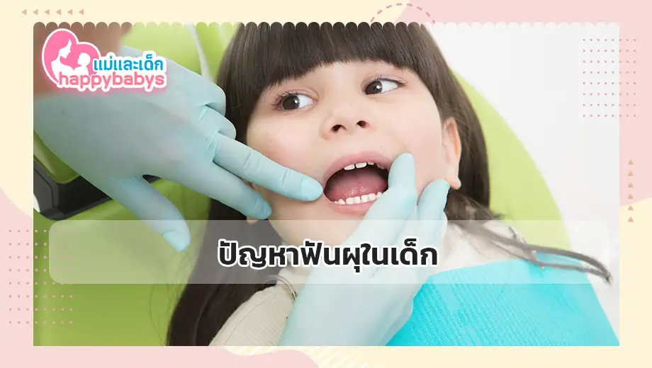 ปัญหาฟันผุในเด็ก